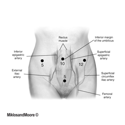 Incision sites of the abdomen