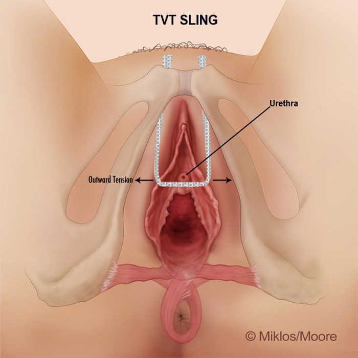 Vagina Hurting During Sex 30